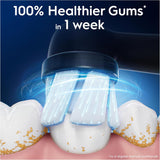 Oral-B iO Gentle Care replacement brush heads in black, 4-pack, designed for electric toothbrushes with soft bristles for gentle cleaning.